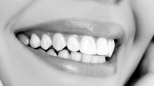 Peptides de collagène et inflammation parodontale